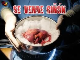 imagesqtbnANd9GcSIjBLzz5dDl74oRlc lsivoreQaRxNq7LptVrvIWbvZrGoOL5B0g - Se vende riñón Tvrip Español