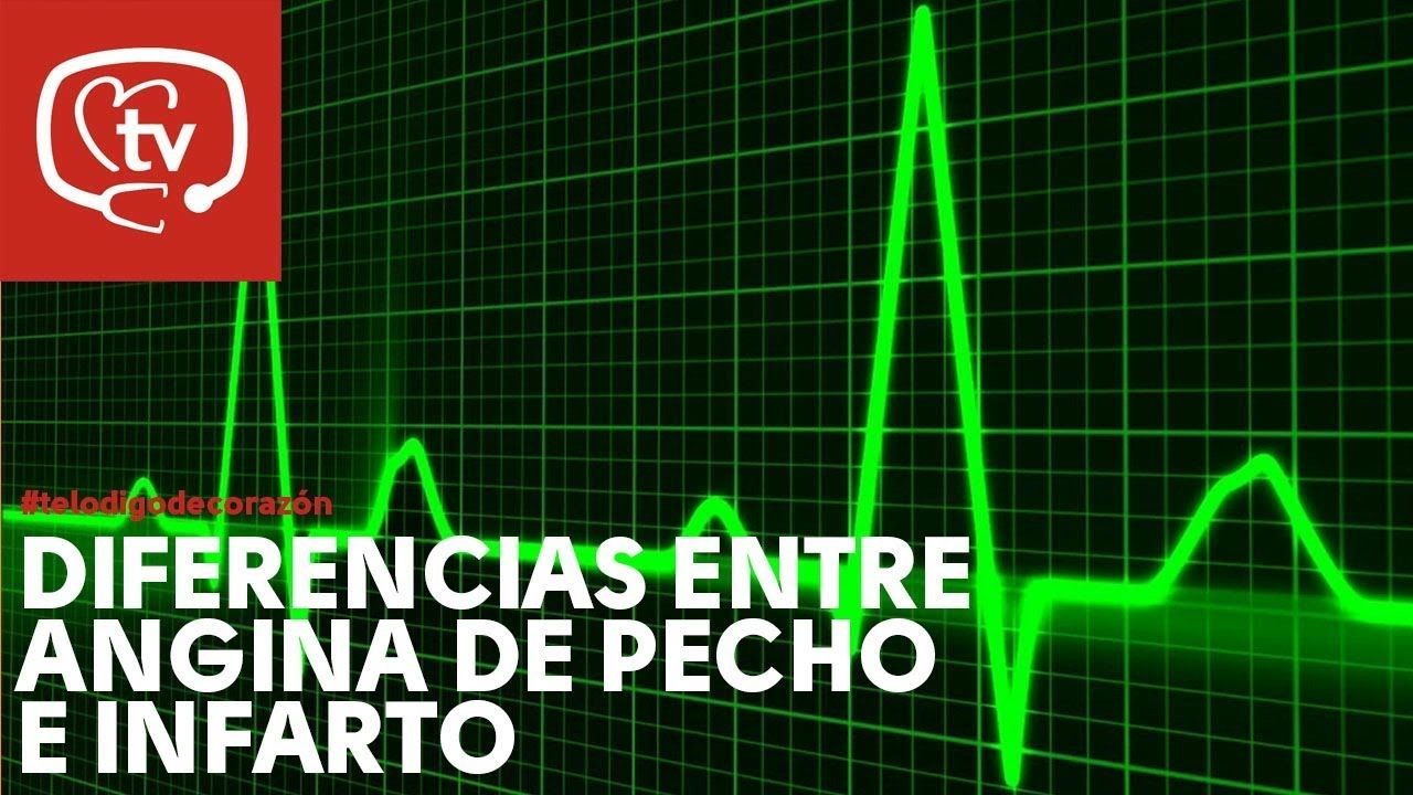 maxresdefault 80 - Angina de pecho e infarto - Carmen Amorós Galitó (Audiolibro Voz NO Humana)